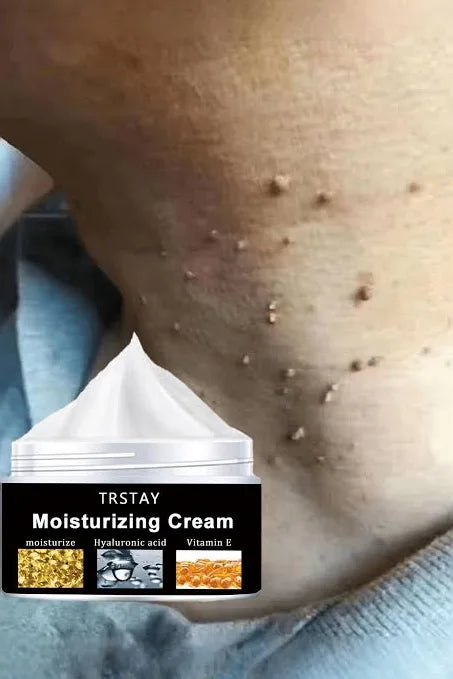 TRSTAY MOISTURIZER CREAM